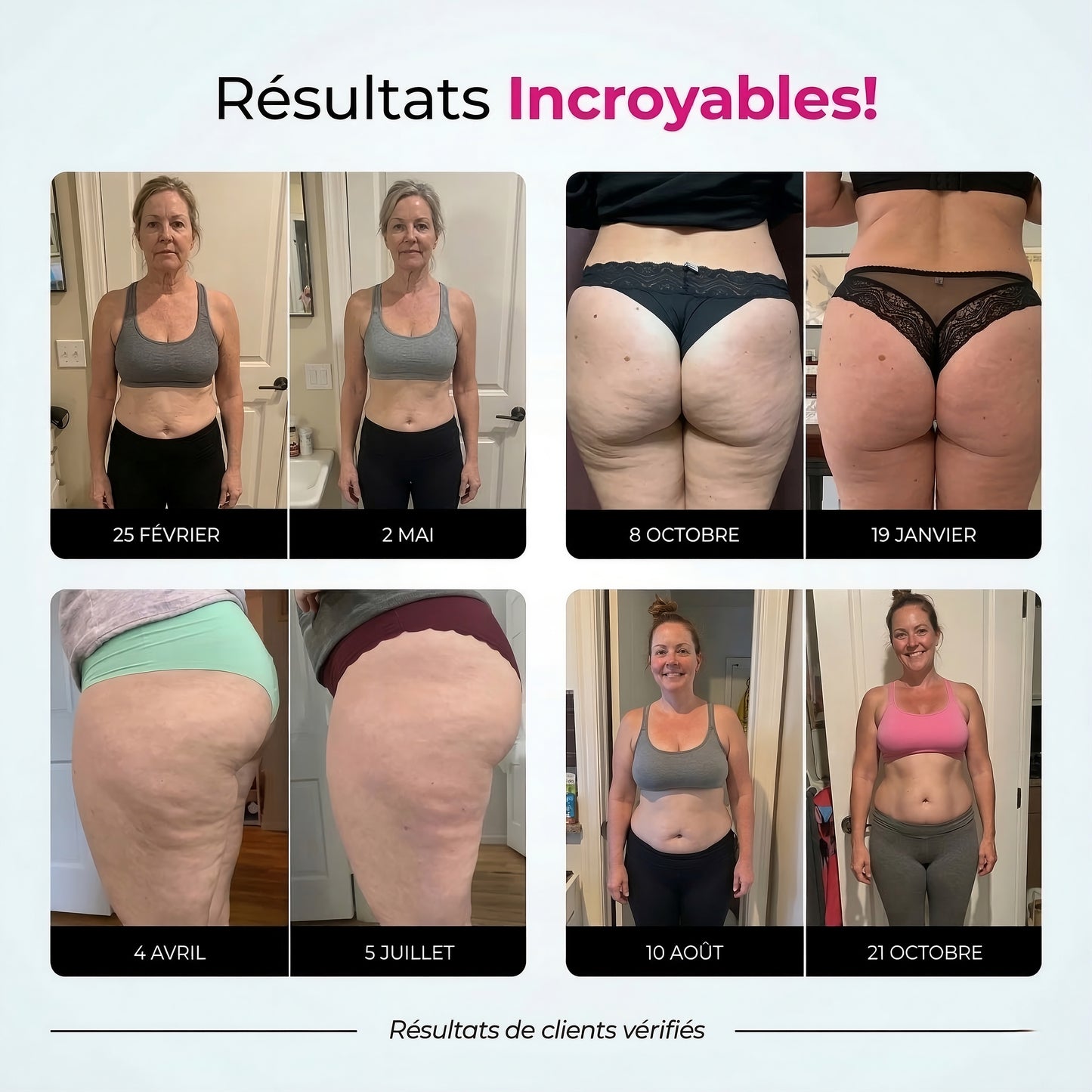 Leggings anti-cellulite à compression 3D
